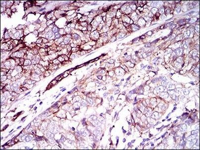 CD59 Antibody in Immunohistochemistry (Paraffin) (IHC (P))