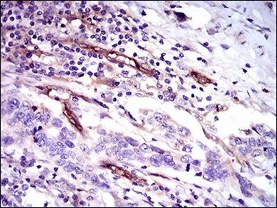 CD59 Antibody in Immunohistochemistry (Paraffin) (IHC (P))