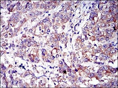 CD6 Antibody in Immunohistochemistry (Paraffin) (IHC (P))