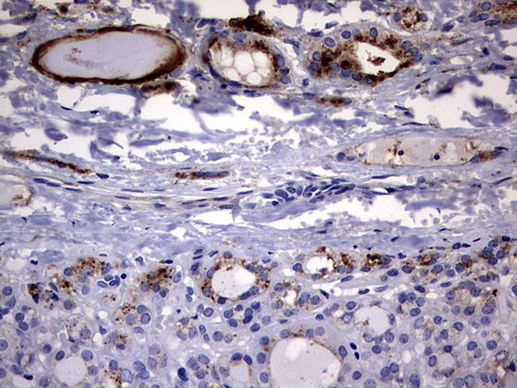 CD63 Antibody in Immunohistochemistry (Paraffin) (IHC (P))