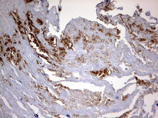 CD63 Antibody in Immunohistochemistry (Paraffin) (IHC (P))