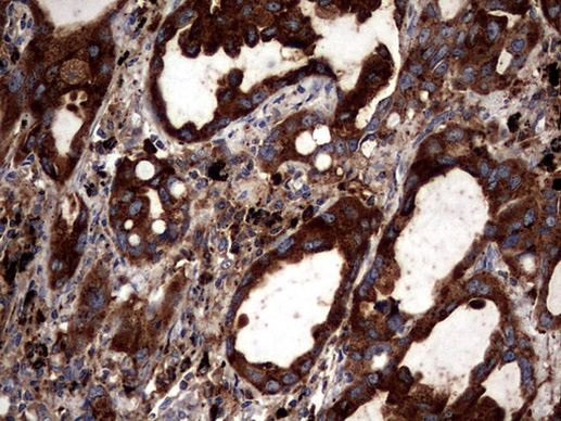 CD63 Antibody in Immunohistochemistry (Paraffin) (IHC (P))