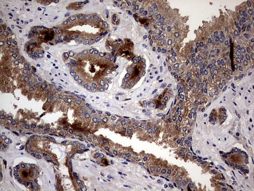 CD63 Antibody in Immunohistochemistry (Paraffin) (IHC (P))