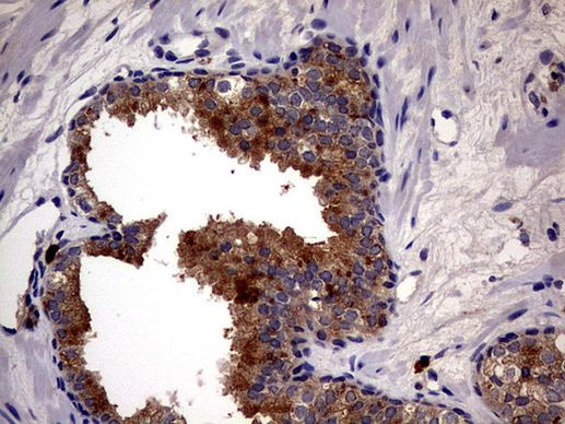 CD63 Antibody in Immunohistochemistry (Paraffin) (IHC (P))