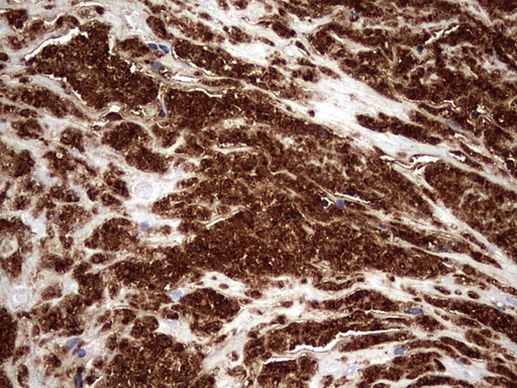 CD63 Antibody in Immunohistochemistry (Paraffin) (IHC (P))