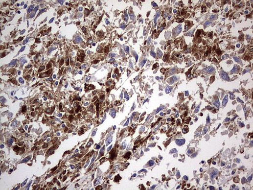 CD63 Antibody in Immunohistochemistry (Paraffin) (IHC (P))