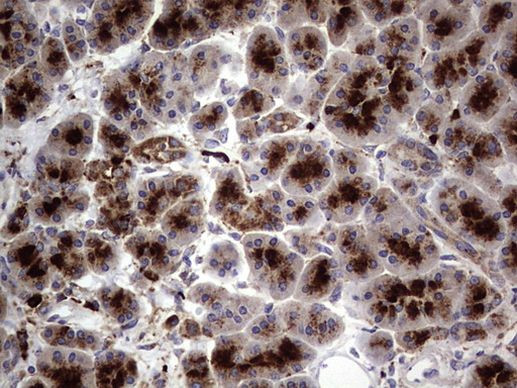 CD63 Antibody in Immunohistochemistry (Paraffin) (IHC (P))