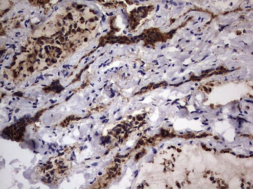 CD63 Antibody in Immunohistochemistry (Paraffin) (IHC (P))