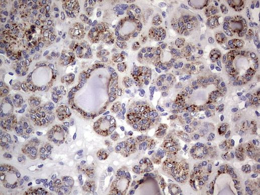 CD63 Antibody in Immunohistochemistry (Paraffin) (IHC (P))