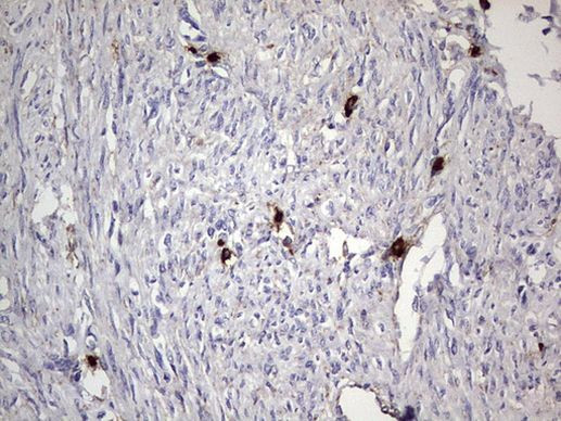 CD63 Antibody in Immunohistochemistry (Paraffin) (IHC (P))