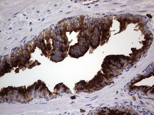 CD63 Antibody in Immunohistochemistry (Paraffin) (IHC (P))