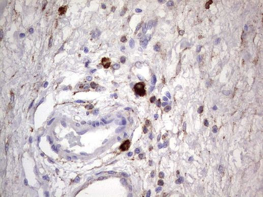 CD63 Antibody in Immunohistochemistry (Paraffin) (IHC (P))