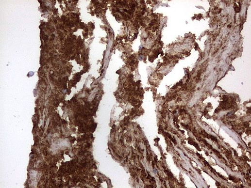 CD63 Antibody in Immunohistochemistry (Paraffin) (IHC (P))