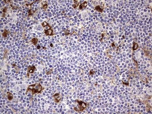 CD63 Antibody in Immunohistochemistry (Paraffin) (IHC (P))