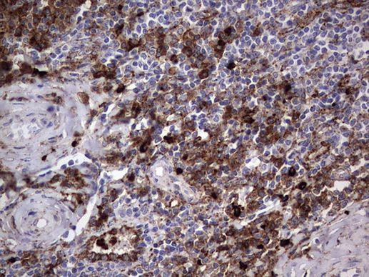 CD63 Antibody in Immunohistochemistry (Paraffin) (IHC (P))