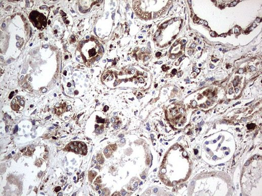 CD63 Antibody in Immunohistochemistry (Paraffin) (IHC (P))