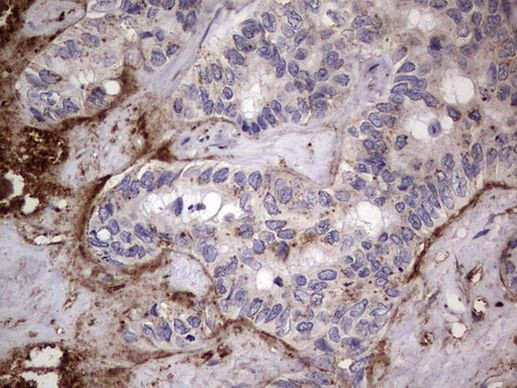 CD63 Antibody in Immunohistochemistry (Paraffin) (IHC (P))