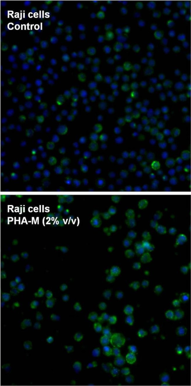 CD69 Antibody in Immunocytochemistry (ICC/IF)