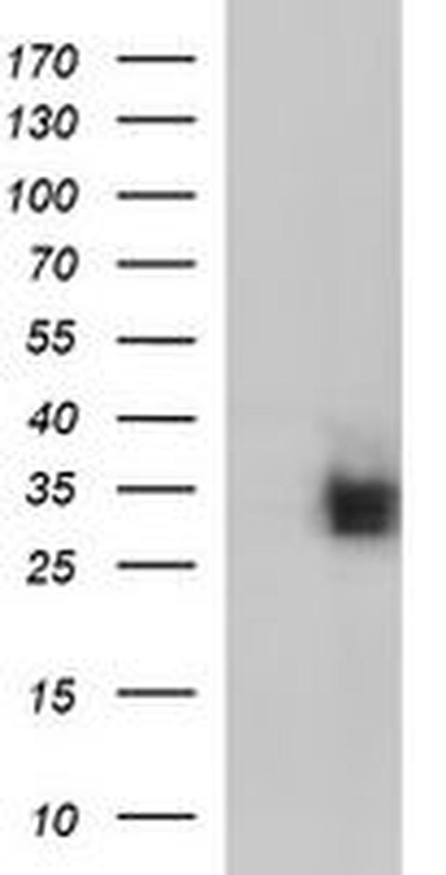 CD7 Antibody in Western Blot (WB)