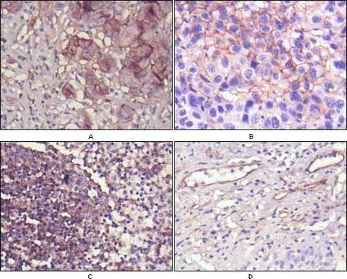 CD73 Antibody in Immunohistochemistry (Paraffin) (IHC (P))