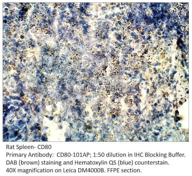 CD80 Antibody in Immunohistochemistry (IHC)