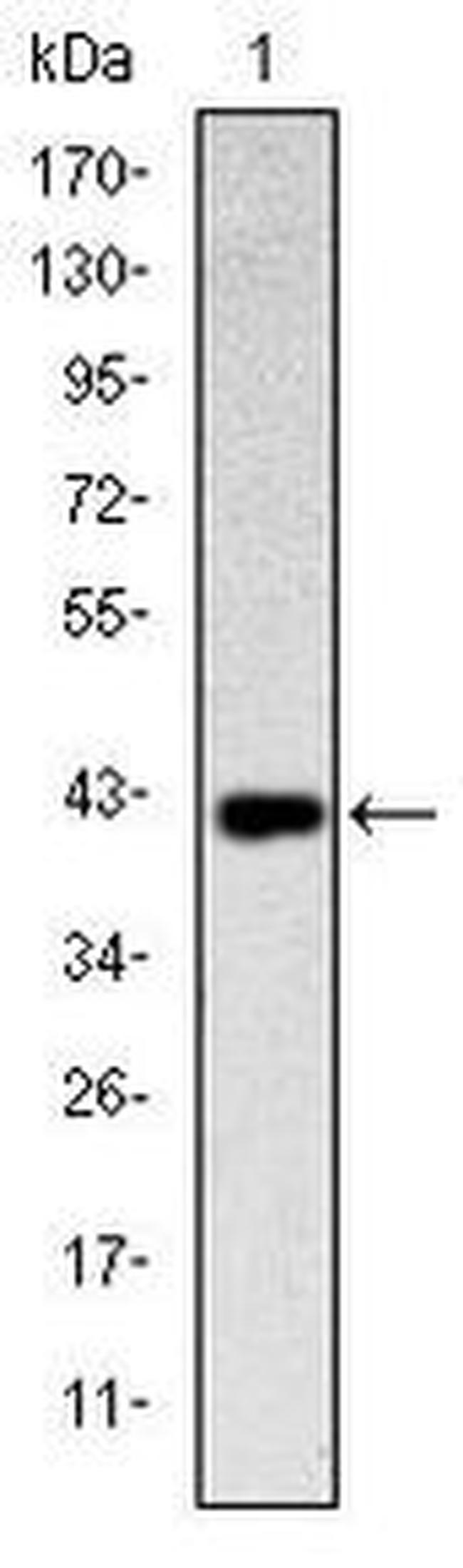 CD94 Antibody in Western Blot (WB)