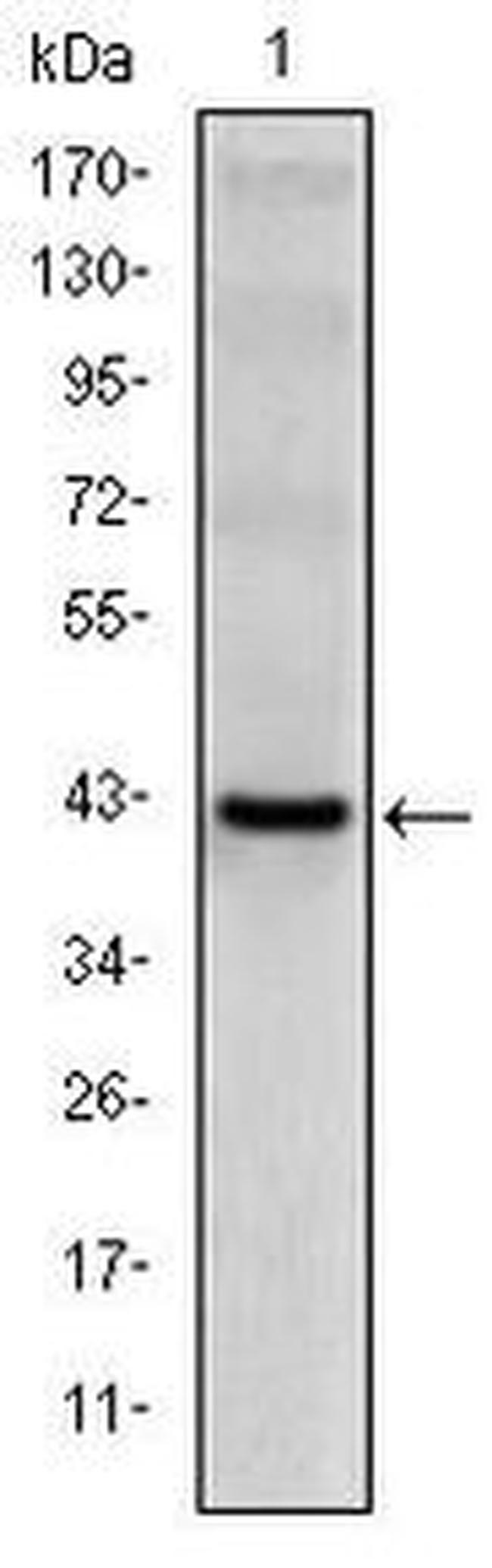 CD94 Antibody in Western Blot (WB)