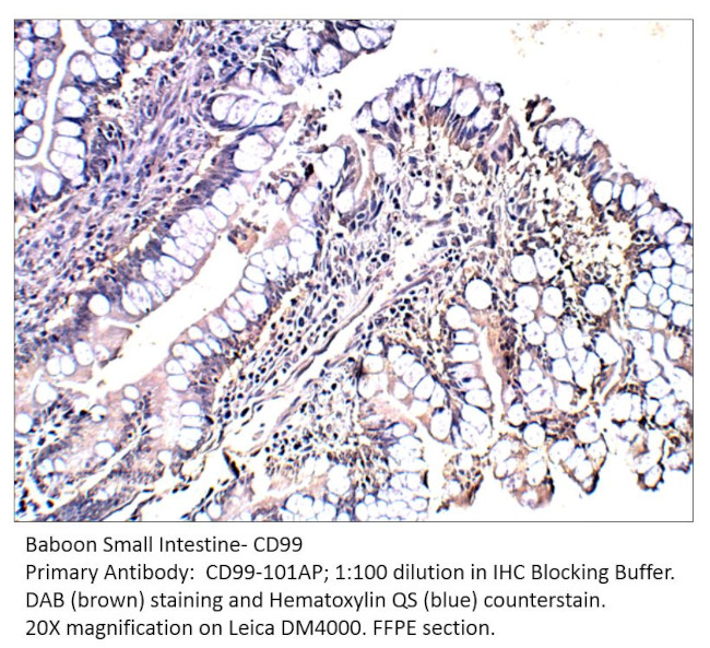 CD99 Antibody in Immunohistochemistry (IHC)