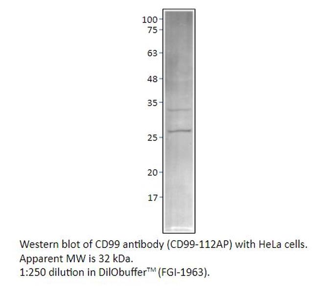 CD99 Antibody in Western Blot (WB)