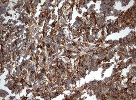 CD99 Antibody in Immunohistochemistry (Paraffin) (IHC (P))