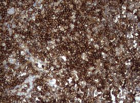 CD99 Antibody in Immunohistochemistry (Paraffin) (IHC (P))