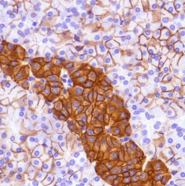 CD99 Antibody in Immunohistochemistry (Paraffin) (IHC (P))