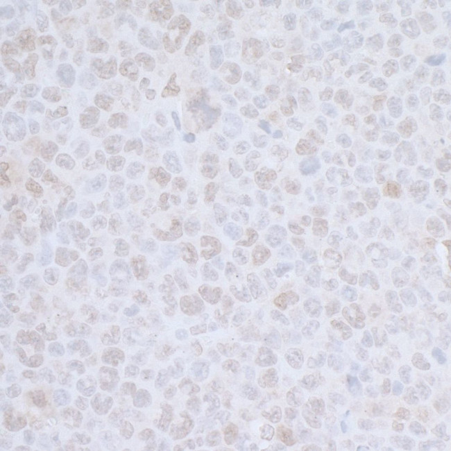 CDC20 Antibody in Immunohistochemistry (IHC)