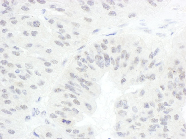 CDC20 Antibody in Immunohistochemistry (IHC)