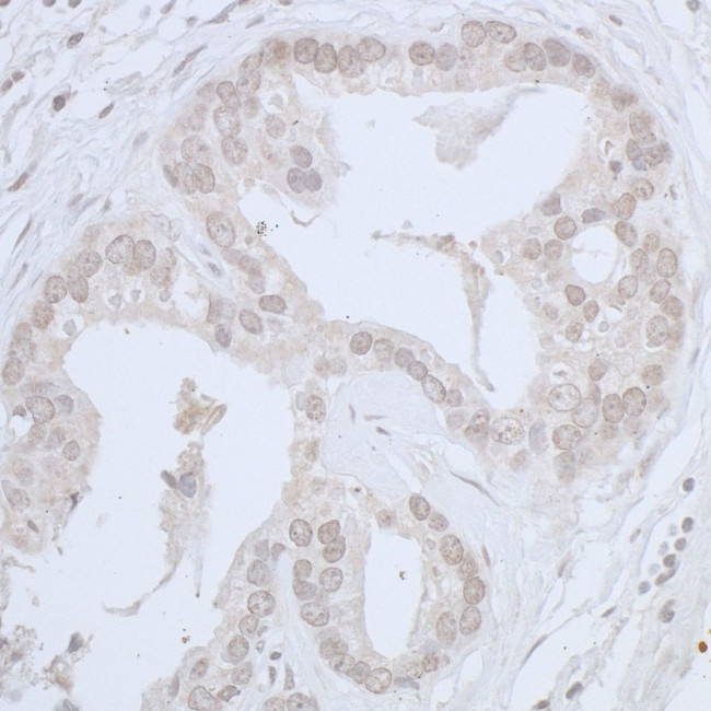 CDC20 Antibody in Immunohistochemistry (IHC)