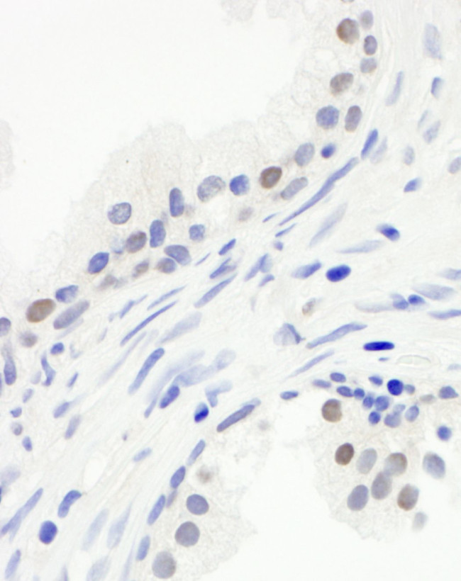 CDC20 Antibody in Immunohistochemistry (IHC)