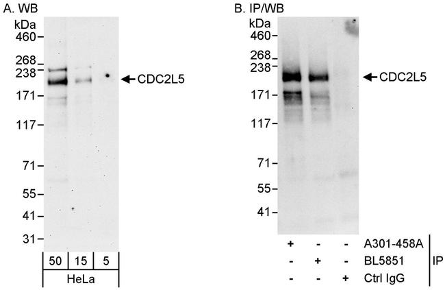 CDC2L5 Antibody in Western Blot (WB)