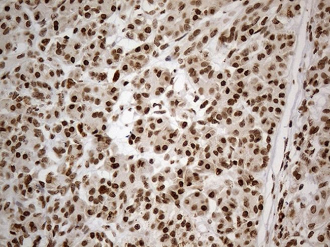 CDC45 Antibody in Immunohistochemistry (Paraffin) (IHC (P))