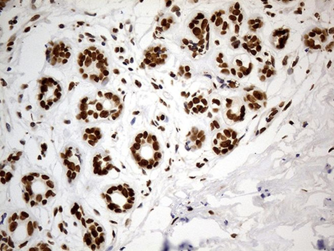 CDC45 Antibody in Immunohistochemistry (Paraffin) (IHC (P))