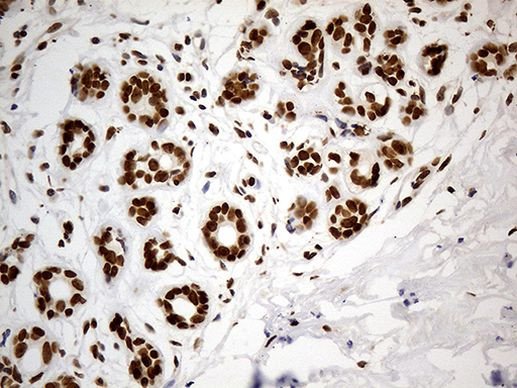 CDC45 Antibody in Immunohistochemistry (Paraffin) (IHC (P))