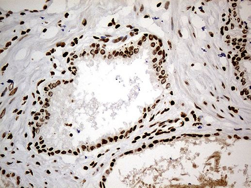 CDC45 Antibody in Immunohistochemistry (Paraffin) (IHC (P))