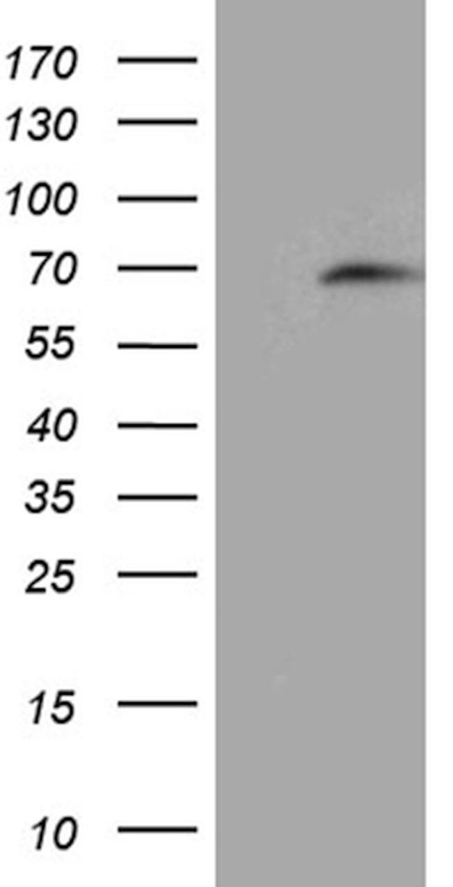 CDC45 Antibody in Western Blot (WB)