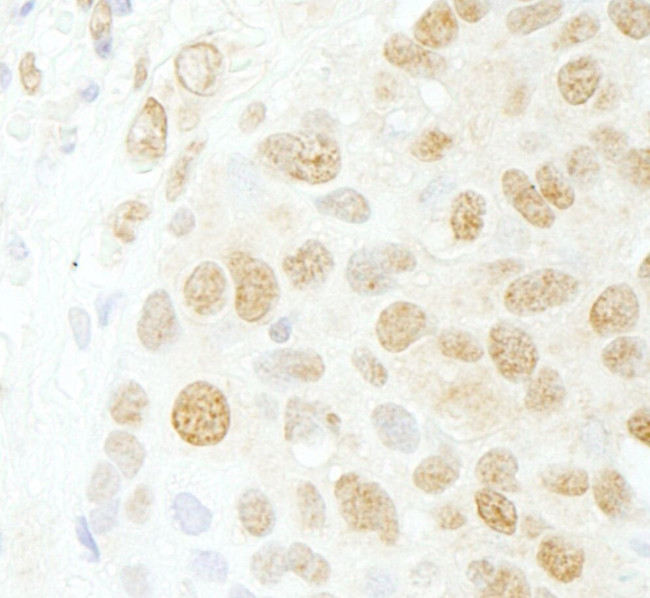 CDC5L Antibody in Immunohistochemistry (IHC)