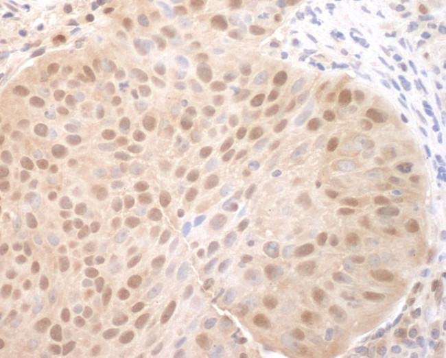 CDC6 Antibody in Immunohistochemistry (IHC)