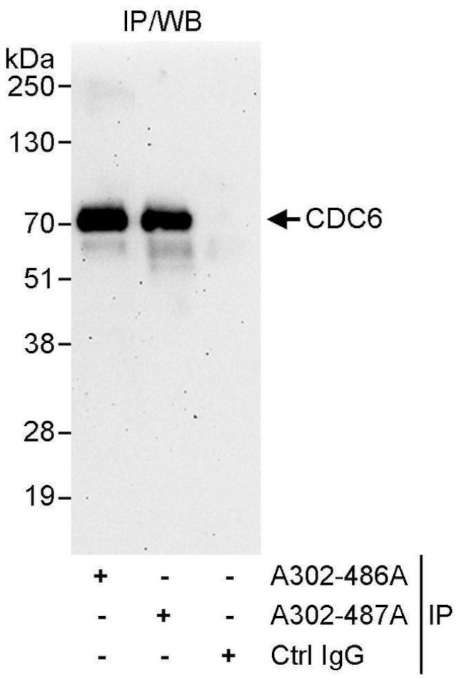 CDC6 Antibody in Immunoprecipitation (IP)