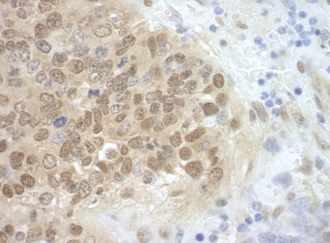 CDC6 Antibody in Immunohistochemistry (IHC)