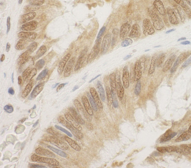 CDC6 Antibody in Immunohistochemistry (IHC)