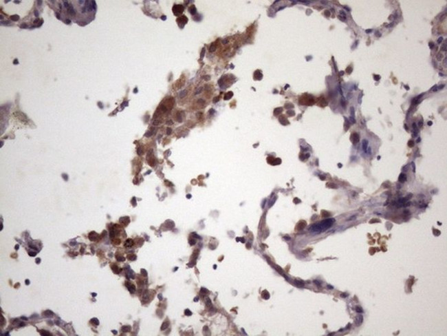 CDC6 Antibody in Immunohistochemistry (Paraffin) (IHC (P))