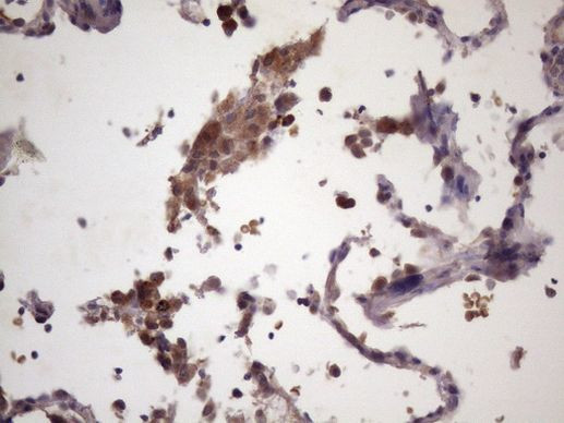 CDC6 Antibody in Immunohistochemistry (Paraffin) (IHC (P))