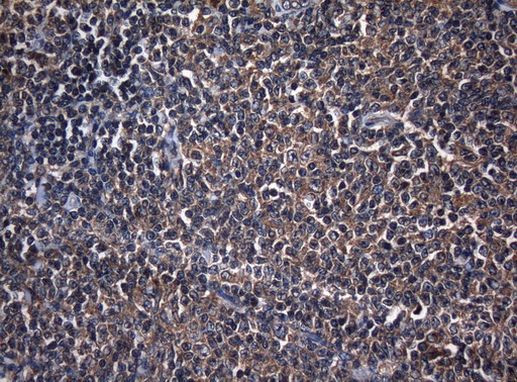 CDC6 Antibody in Immunohistochemistry (Paraffin) (IHC (P))